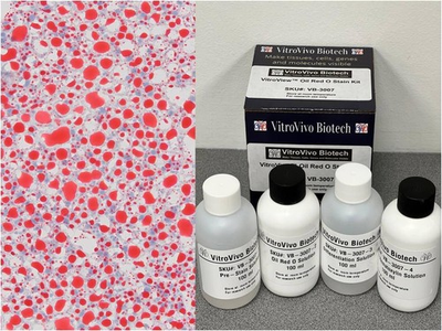 #ad VitroView™ Oil Red O Stain Kit Cat# VB 3007 $219.00