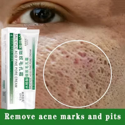 Pore Shrinking Cream Elimination Large Pores Blackehead Remove Acne Pit Repair G