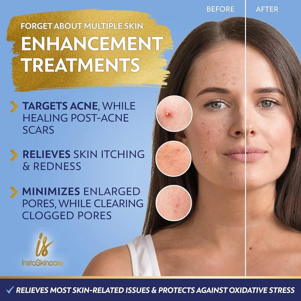 Niacinamid Serum 8 Unzen für Gesicht 10 % mit Zink 1 % Vitamin B3 Aufhellendes Serum - Bild 4 von 4