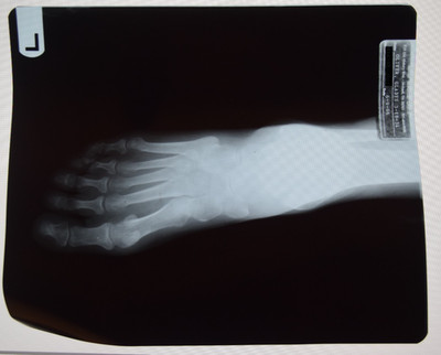 Original Foot X-Ray scan Medical Anatomy Skeleton Bones - READ DESCRIPTION