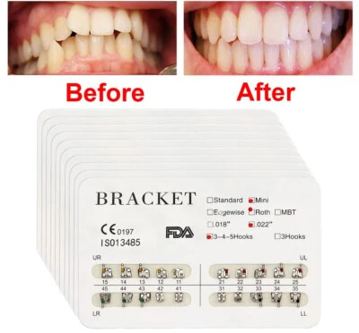ELABPAL 10Pcs Dental Orthodontic Brackets Braces Metal Mini MBT/Roth Slot.022 hook 3-4-5