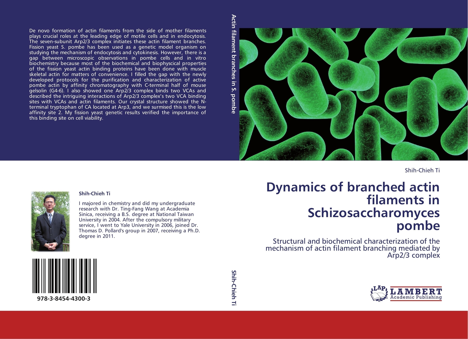 Dynamics Of Branched Actin Filaments In Schizosaccharomyces Pombe | Ti