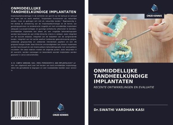 Swathi Vardhan Kasi | Onmiddellijke Tandheelkundige Implantaten | Taschenbuch-image