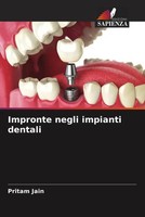 Pritam Jain | Impronte Negli Impianti Dentali | Taschenbuch | Italienisch (2023)