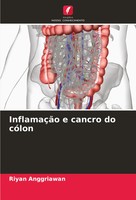 Riyan Anggriawan | InflamaçãO E Cancro Do CóLon | Taschenbuch | Portugiesisch