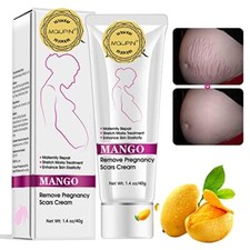 Crema Para Las Estrias Ideal Para Mujeres Embarazadas Luce Tu Piel Sin Miedo