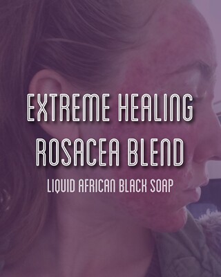 Fra Fra s Naturals | Premium EXTREME Healing Rosacea Whipped Shea Butter Blend