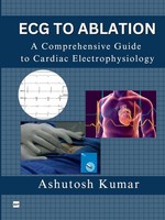 Ecg To Ablation A Comprehensive Guide To Cardiac Electrophysiology Kumar Buch