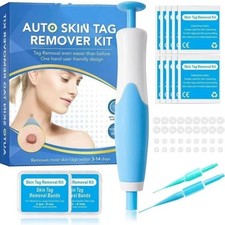 Auto Micro Skin Tag Remover Device Kit Safe Painless Removal 2-8 mm Band Tool