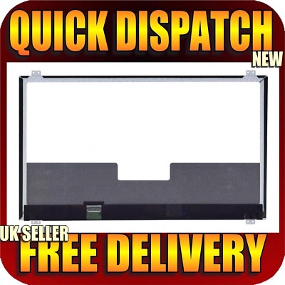 Lg Display 17,3'' eDP 30 Pin FHD LP173WF4-SPD1 Bildschirm für Asus G751 G751JM G751JY