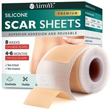 Silicone Scar Sheets,Silicone Scar Tape 1.6"x 120" Roll-3M , Reusable and Eff...