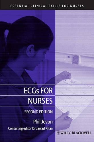 ECGs for Nurses 2e Jevon Paperback Wiley–Blackwell 9781405181624