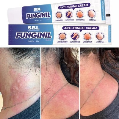 SBL Funginil Cream (25g) support skin wellness