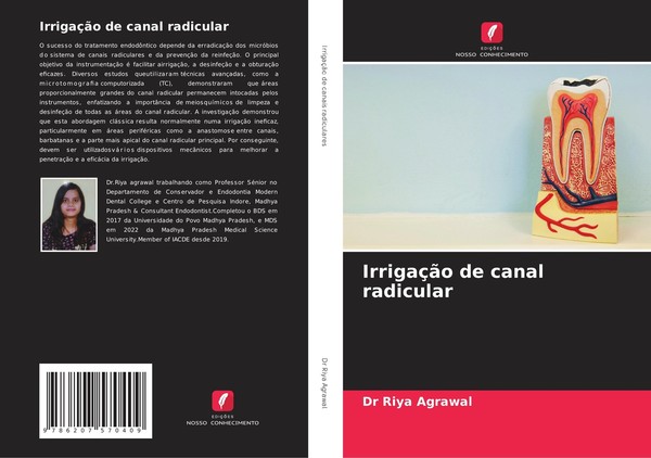 IrrigaçãO De Canal Radicular Riya Agrawal-image