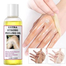 Extra Strong Peeling Oil Body Skin Brightening Exfoliating Peel Off Remover110ml