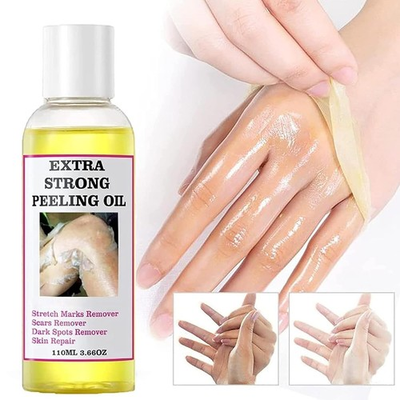 #ad Extra Strong Peeling Oil Body Skin Brightening Exfoliating Peel Off Remover110ml $17.99