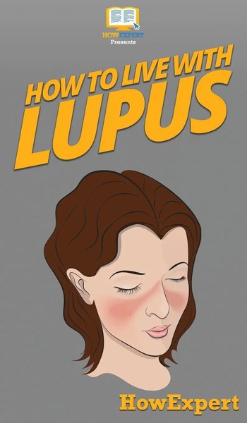 HowExpert | How To Live With Lupus | Buch | Englisch (2020) | Gebunden-image