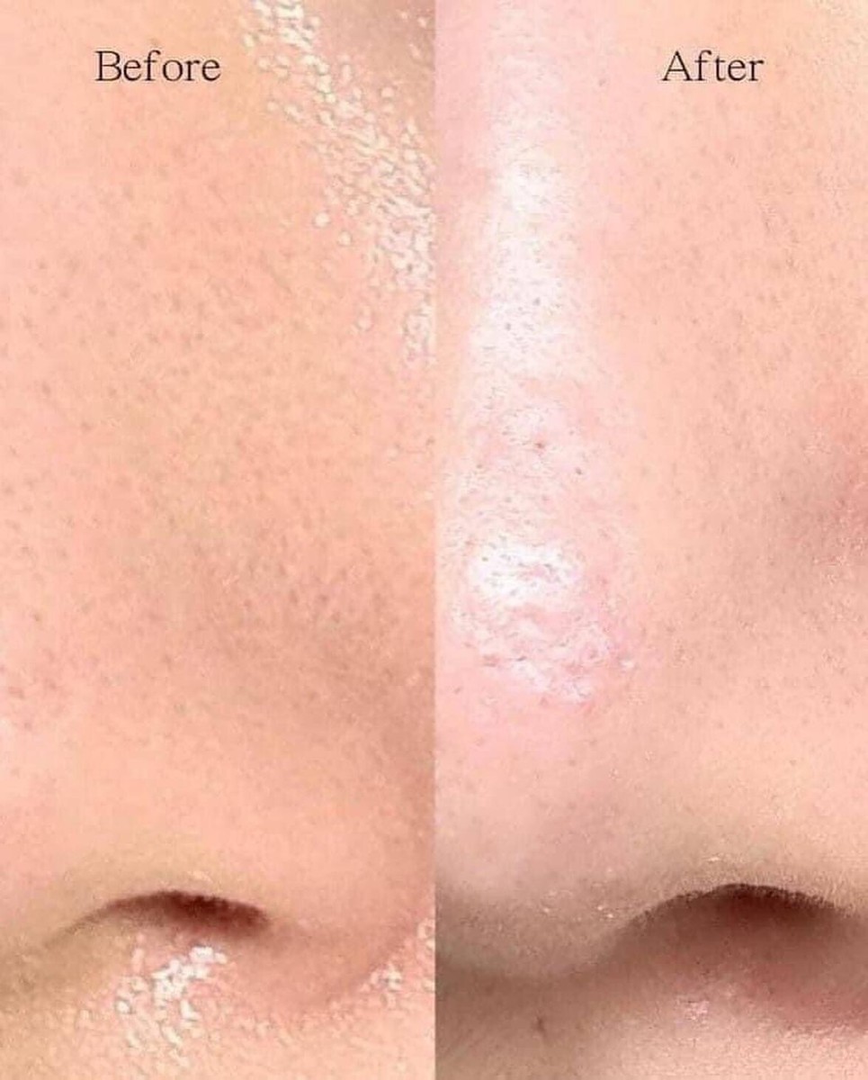 ilso SUPER MELTING SEBUM SOFTENER 150ml | eBay