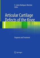 Articular Cartilage Defects Of The Knee E. Carlos RodrìGuez-MercháN