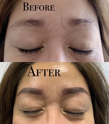 Featured image of post Korean Eyebrow Tattoo Perth : Then they would have a tattooist draw them on again according to the desires of the lady getting them drawn.