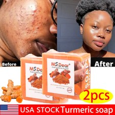 2  Tumeric Soap Skin Whitening Dark Spots lightening Acne Brightening Turmeric