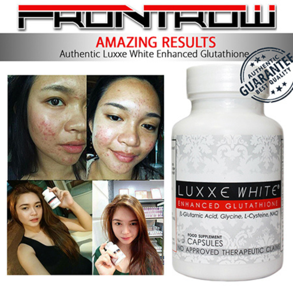 Luxxe White 775mg | Premium Glutathione - US Authorized, Genuine &  Guaranteed