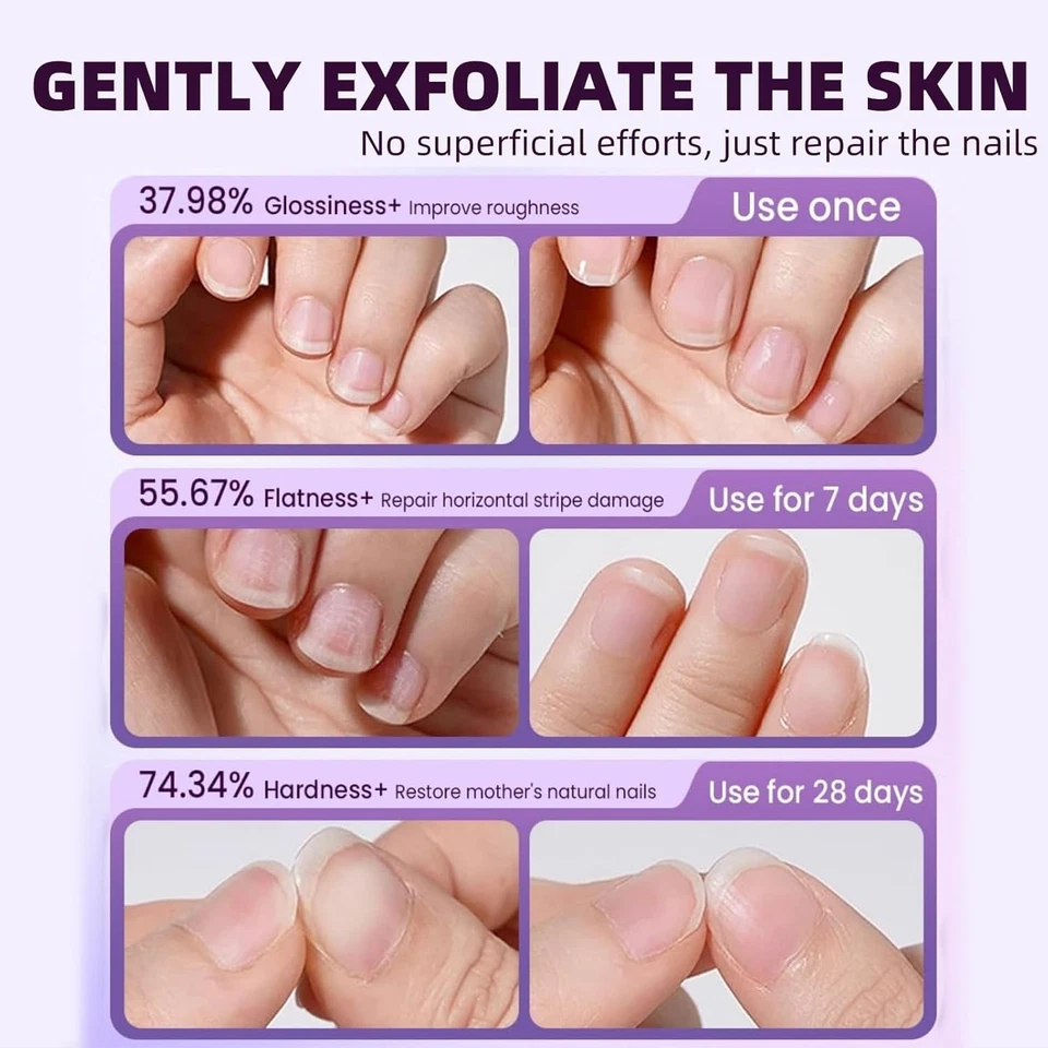 3-in-1 Nail Care Pen, Cuticle Pusher Oil Pen with Ceramic Tip for...  - Image 4 of 4