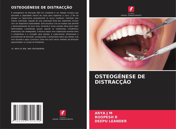 Arya J M (U. A.) | OsteogÉNese De DistracÇÃO | Taschenbuch | Portugiesisch-image