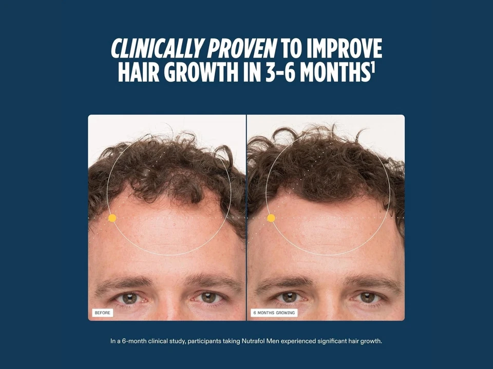 Suplemento de soporte capilar para hombre 3 piezas | 360 cápsulas | Botella de vidrio | Totalmente natural Foto 4 de 4