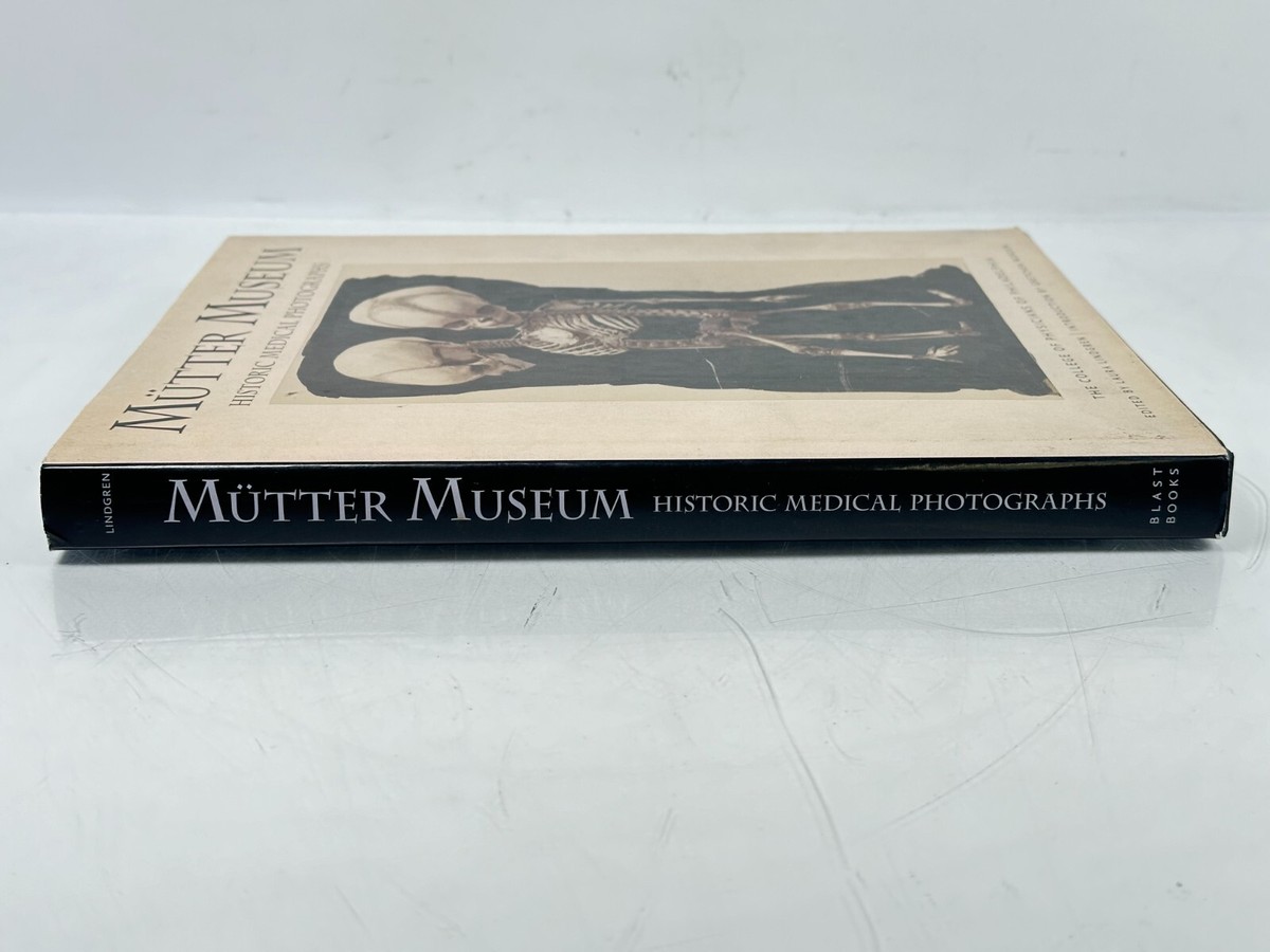 Mütter Museum Historic Medical Photographs by Laura Lindgren