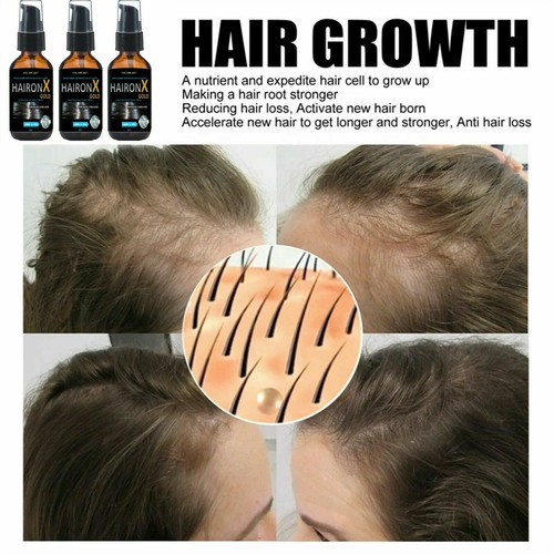 Aceite de crecimiento de barba HaironX suero de crecimiento rápido bigote aseo para hombres - Imagen 8 de 12