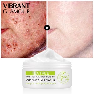 anti acne face cream