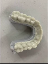 DIY Denture Kit Complete Custom Upper and Lower Snap-on Veneer 