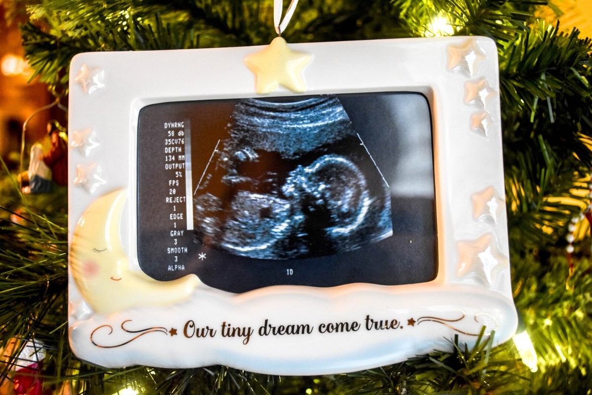 Hallmark Dream Come True Sonogram Photo Holder Keepsake Ornament LIMITED NO  DATE