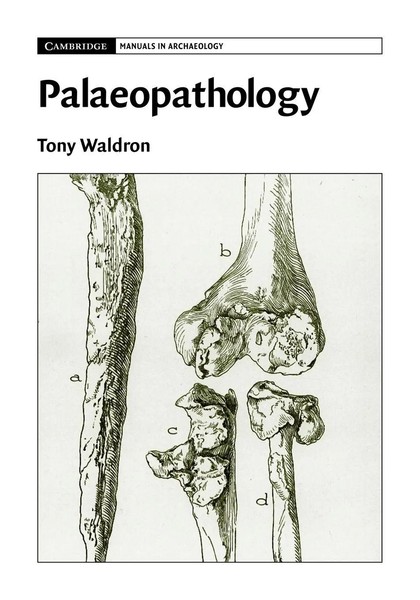 Palaeopathology Tony Waldron Taschenbuch Kartoniert / Broschiert Englisch 2015-image
