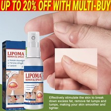 50ML Lipomheilung Reduction Spray, Instant LumpFree Lipoma Removal Spray USA Hot