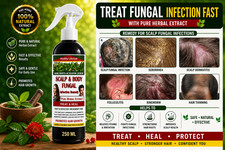 Image of Itchy Sore Scalp Seborrhea Dandruff Acne Warts - PURE HERBAL EXTRACT 250 ML