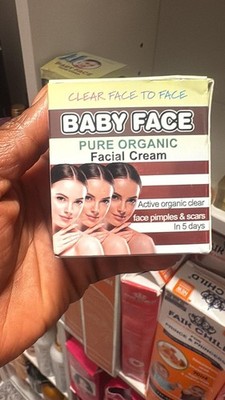 Baby Face Face Cream for Acne Dark Spots Pimples and Lightening 30g