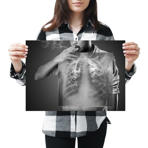 A3 - Raucher Lunge Röntgen Rauchen Wissenschaft Poster 42 x 29,7 cm 280 g/m² (BW) #43786