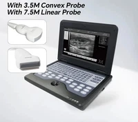 LCD Ultrasound Scanner Laptop Machine Diagnostic System Convex+Linear 2 Probes