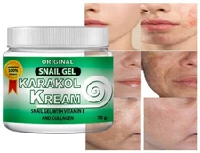 Karakol kream dark spot face skincare snail cream,crema de caracol,acne moisture
