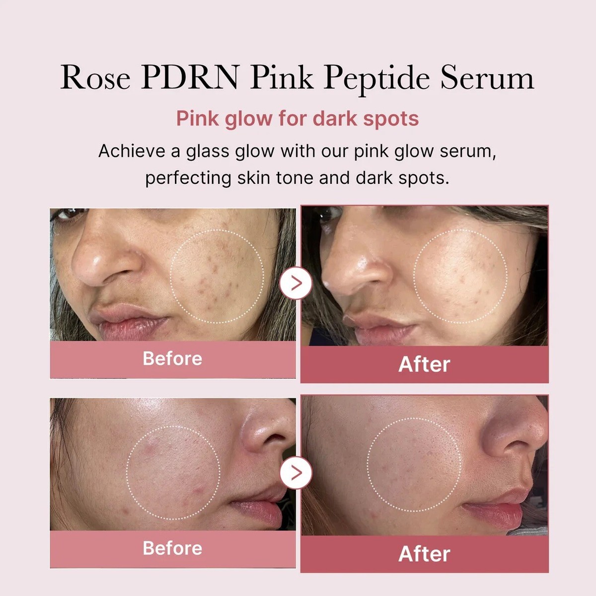 MEDICUBE PDRN Pink Peptide Serum 30ml PDRN 10,000ppm K