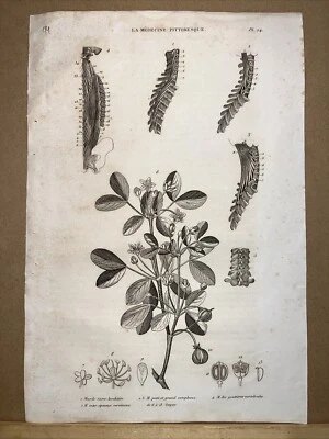Antiquarische Stahlstich 1834 Anatomie Medizine Chirurgie Arzt Doktor Botanik - Bild 1 von 4
