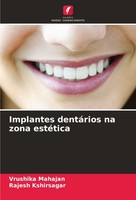 Implantes DentáRios Na Zona EstéTica Vrushika Mahajan
