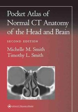 Pocket Atlas of Normal CT Anatomy of the Head and Brain by Michelle M. Smith (En