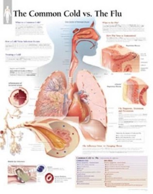Common Cold vs the Flu Laminated Poster - 9781930633797