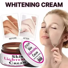 KOJIC ACID Skin Whitening Lightening Ultra Brightening Dark Spot Cream