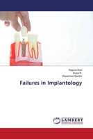 Saguna Kaul (U. A.) | Failures In Implantology | Taschenbuch | Englisch (2023)