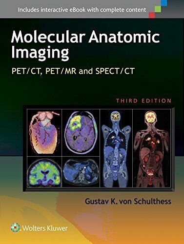 Molecular Anatomic Imaging: PET/CT, PET/MR and SPECT CT by Von-Schulthess New+- - Foto 1 di 1