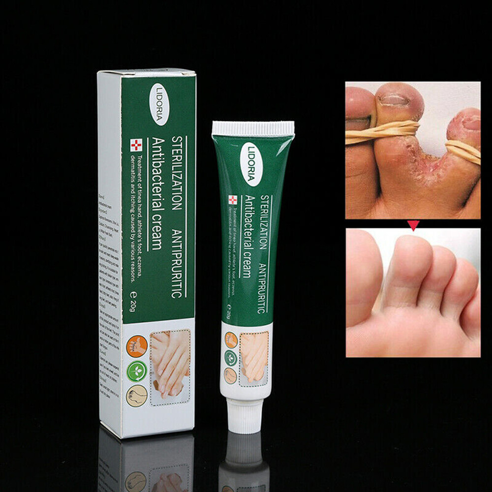 Anti Fungal Infections Hand Foot Cream Pain Relief Beriberi Feet